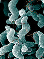 Free Stock Photo: Campylobacter bacteria as seen from an electron microscope
