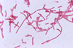 Free Stock Photo: Bacteroides hypermegas bacteria