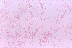 Free Stock Photo: Bacteroides fragilis subsp. ovatus bacteria