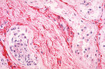 Free Stock Photo: Microscopic view of ebola virus antigen