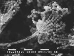 Free Stock Photo: Scanning electron micrograph of Aspergillus fungal fruiting body