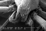 Free Stock Photo: Scanning electron micrograph of a brown recluse spider.