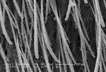 Free Stock Photo: Scanning electron micrograph of a brown recluse spider.