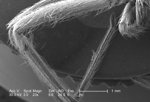 Free Stock Photo: Scanning electron micrograph of a brown recluse spider.