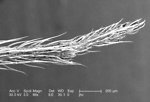 Free Stock Photo: Scanning electron micrograph of a brown recluse spider.