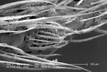 Free Stock Photo: Scanning electron micrograph of a brown recluse spider.