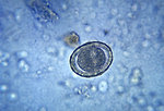 Free Stock Photo: Micrograph of a fertilized round worm egg.