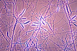 Free Stock Photo: Microscopic photo of fungus