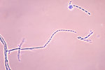Free Stock Photo: Microscopic photo of fungus