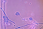 Free Stock Photo: Microscopic photo of fungus