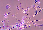 Free Stock Photo: Microscopic photo of fungus
