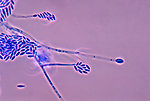 Free Stock Photo: Microscopic photo of fungus