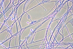 Free Stock Photo: Microscopic photo of fungus