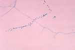 Free Stock Photo: Microscopic photo of fungus
