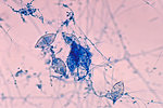 Free Stock Photo: Microscopic photo of fungus