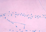 Free Stock Photo: Microscopic photo of fungus