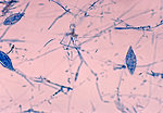 Free Stock Photo: Microscopic photo of fungus