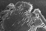Free Stock Photo: Microscopic bedbug scanning electron micrograph.