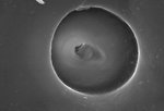Free Stock Photo: Microscopic bedbug scanning electron micrograph.