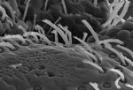 Free Stock Photo: This scanning electron micrograph (SEM) revealed some of the ultrastructural morphology displayed on the exoskeletal surface of a bedbug, Cimex lectularius.  In this particular view, numbers of what appear to be \'hairs\', but are actually known as setae, which are sensorial in nature, and are composed of chitin, as is the entire exoskeleton.