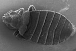 Free Stock Photo: Microscopic bedbug scanning electron micrograph.