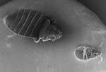 Free Stock Photo: Microscopic bedbug scanning electron micrograph.