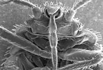 Free Stock Photo: Microscopic bedbug scanning electron micrograph.