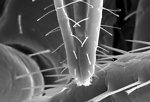 Free Stock Photo: This highly-magnified scanning electron micrograph (SEM) revealed some of the ultrastructural morphology displayed on the rostral head region of a bedbug, Cimex lectularius.  Note the distal anatomical relationships of the insect\'s skin piercing mouthparts used to obtain its blood meal.