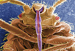 Free Stock Photo: Microscopic bedbug scanning electron micrograph.