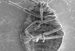 Free Stock Photo: Microscopic bedbug scanning electron micrograph.