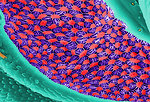 Free Stock Photo: Microscopic bedbug scanning electron micrograph.