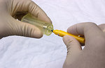 Free Stock Photo: A patient having blood drawn from a doctor