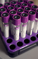 Free Stock Photo: A tray holding blood-filled test tubes